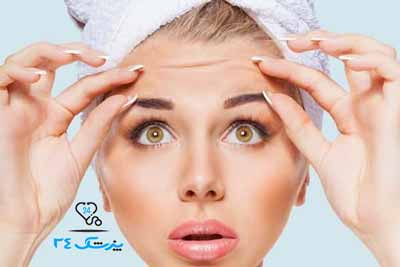 تفاوت لیفت شقیقه و پیشانی