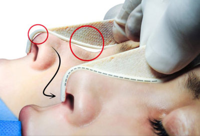 ساخت قالب کنترلی