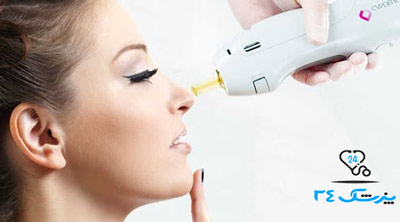 معایب لیزر در جراحی بینی