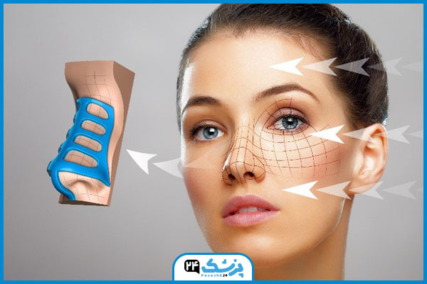 قالب کنترلی در تهران