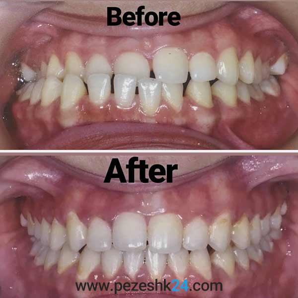 ارتودنسی رایگان