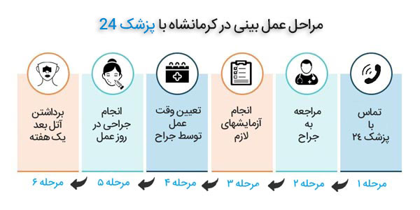 مراحل عمل بینی در کرمانشاه
