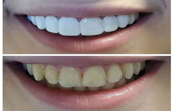 نمونه اسنپ آن اسمایل