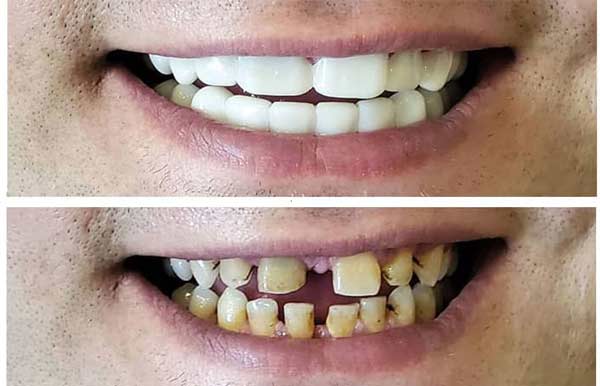 نمونه اسنپ آن اسمایل