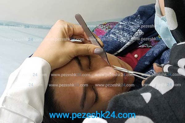 هزینه جراحی بینی در رشت