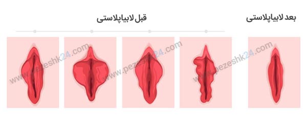 دکتر جراح زیبایی واژن تهران