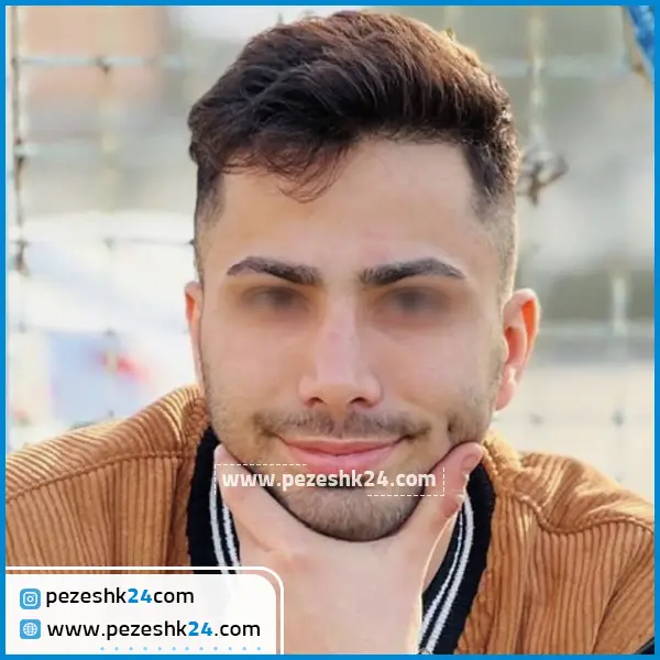 نمونه عمل بینی دکتر محمدرضا محرابی