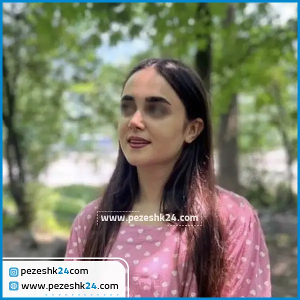 نمونه عمل بینی دکتر محرابی در ساری