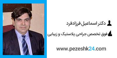 دکتر اسماعیل فرزادفرد جراح بینی در مشهد