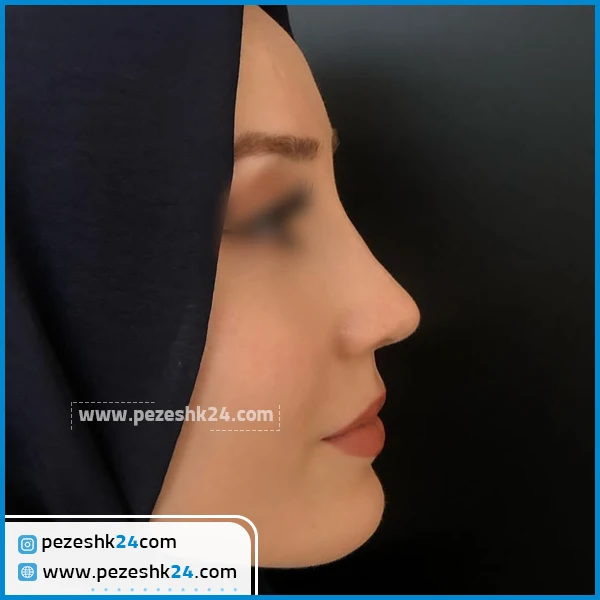 جراح بینی طبیعی تهران