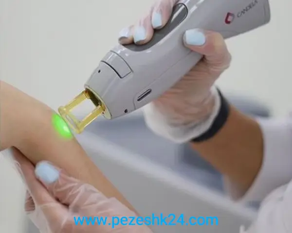 بهترین کلینیک لیزر موهای زائد در شیراز