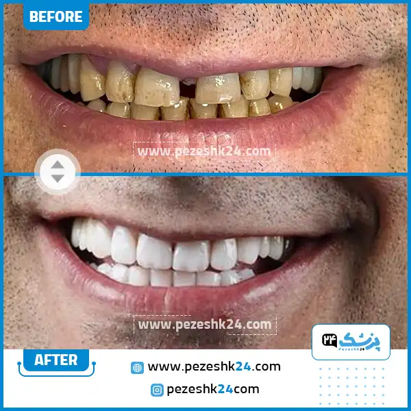 متخصص کامپوزیت دندان رشت