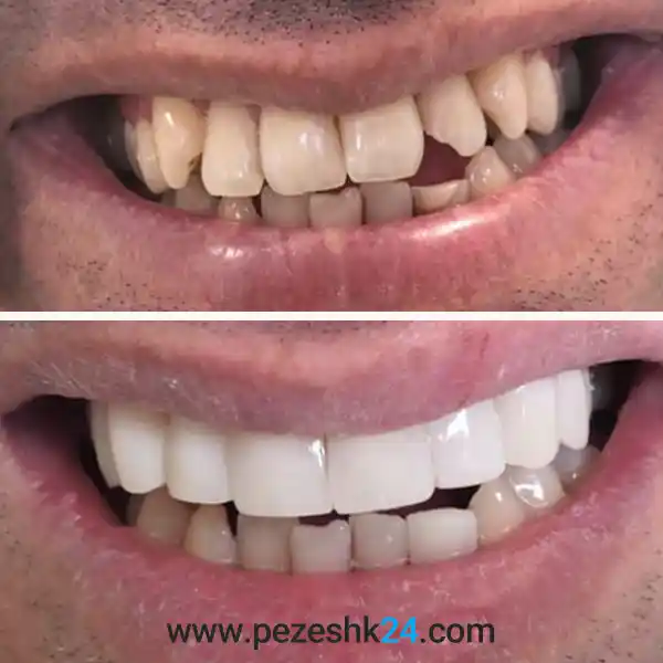 حمید نشاندار اصلی دندانپزشک زیبایی در رشت