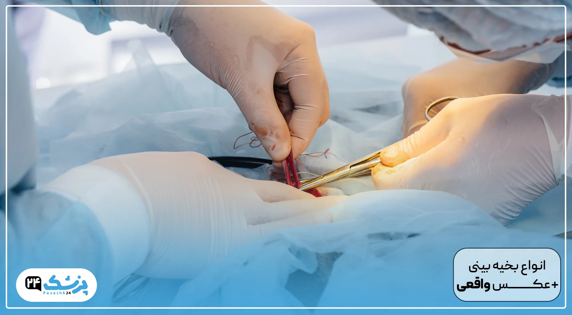 عکس بخیه داخل بینی