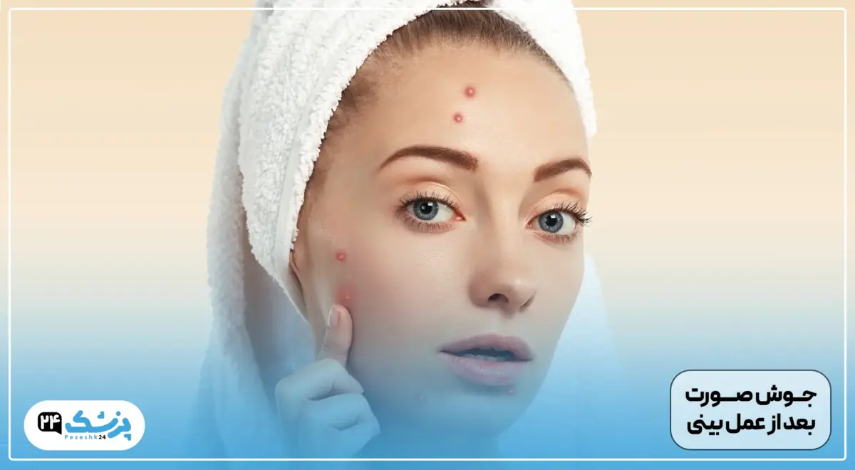 جوش بعد عمل بینی