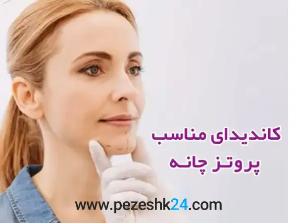 کاندیدای جراحی چانه در مشهد