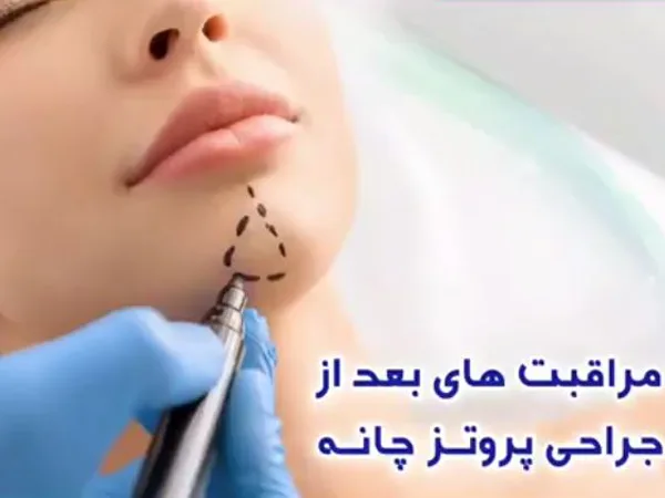 مراقبت های جراحی چانه در مشهد