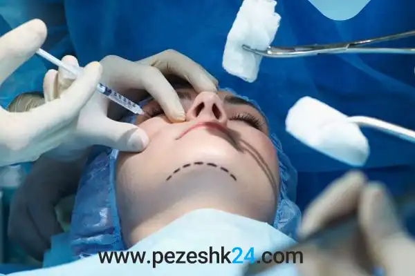 جراحی چانهدر شیراز