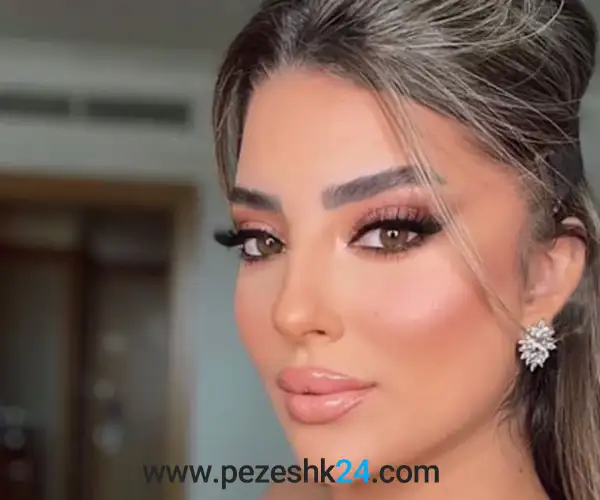 پروتز گونه در رشت