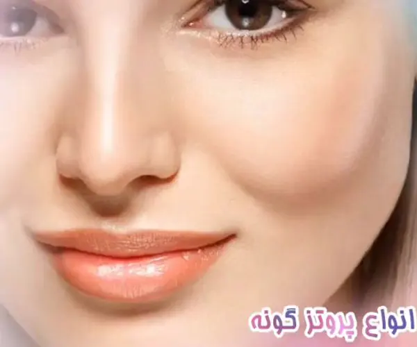 کاشت گونه در رشت