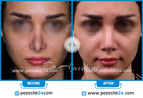 عمل بینی دکتر علی جاودانی در تهران