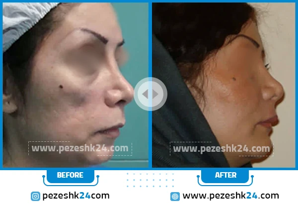 نمونه جراحی دکتر سینا غیاثی 1