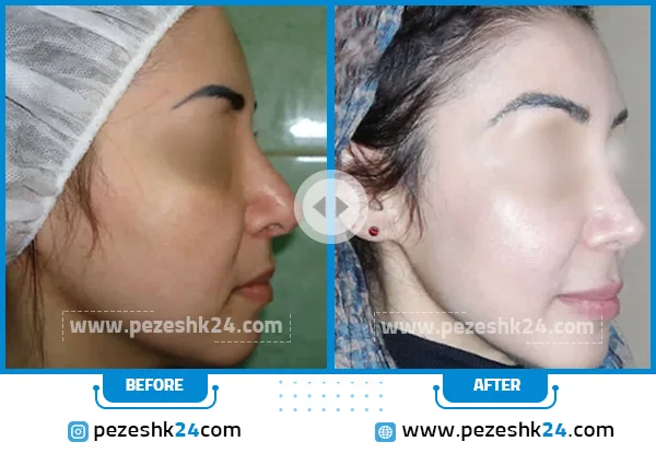 نمونه جراحی دکتر سینا غیاثی 2