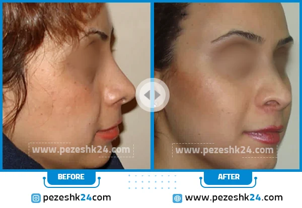نمونه جراحی دکتر سینا غیاثی 3