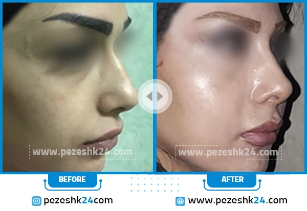 نمونه جراحی دکتر سینا غیاثی 4