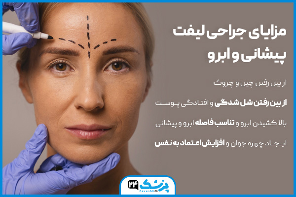 مزایای جراحی لیفت پیشانی و ابرو