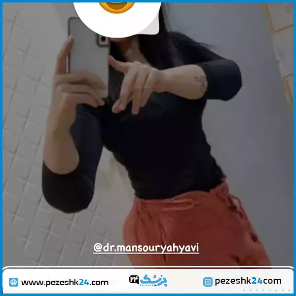 نمونه کار بهترین جراح ابدومینوپلاستی در مشهد دکتر منصور یحیاوی