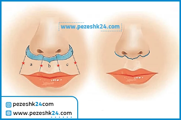 سانترال لب در شیراز