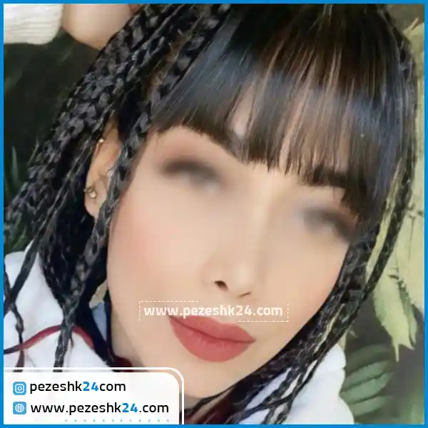 نمونه جراحی بینی دکتر حسین زاده ساری