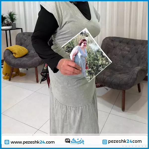 نتیجه پیکرتراشی کل بدن توسط دکتر منصور یحیاوی در مشهد