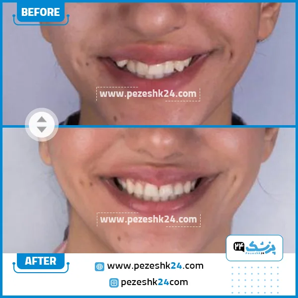 نمونه کار ارتودنسی دکتر رفیعی 1