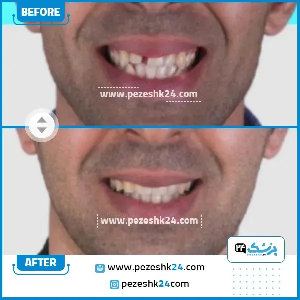 نمونه کار ارتودنسی دکتر رفیعی 2