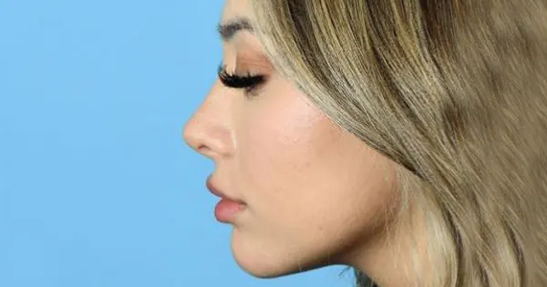 بهترین جراح بینی ساری