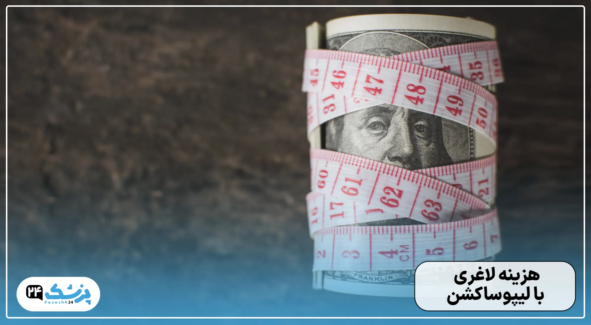 هزینه عمل لیپوساکشن