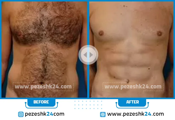 نمونه عمل پیکرتراشی در رشت