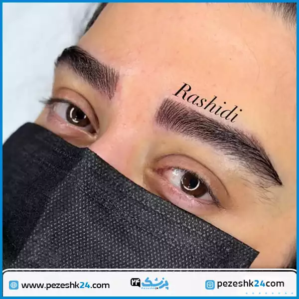 کاشت ابرو مجموعه رشیدی شیراز
