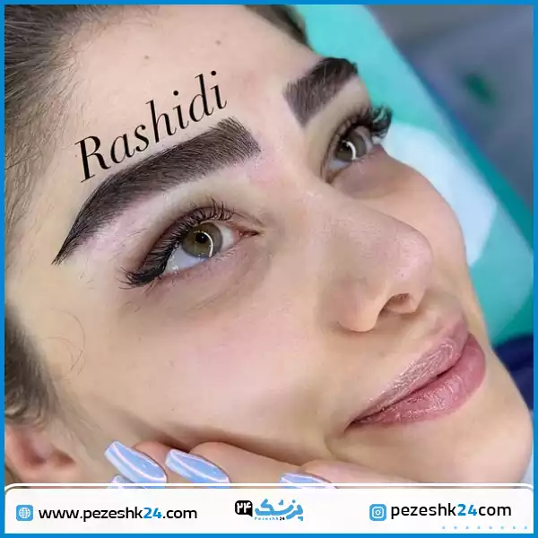 جراحی کاشت ابرو مجموعه رشیدی در شیراز