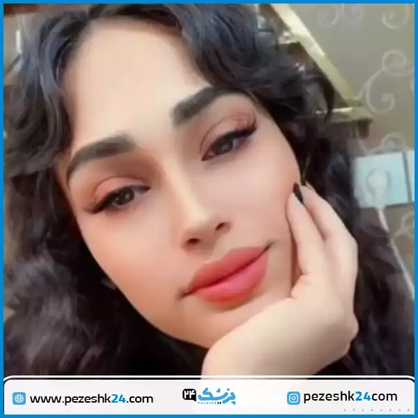 نمونه کاشت ابرو کلینیک دکتر نوبخت شیراز