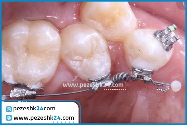 بهترین دکتر ارتودنسی در شیراز