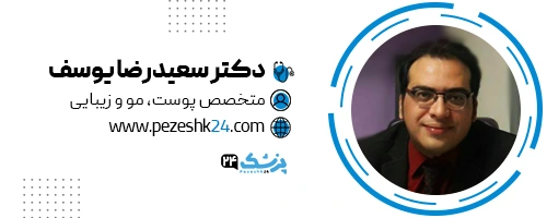 دکتر سعیدرضا یوسف کاشت مو تهران