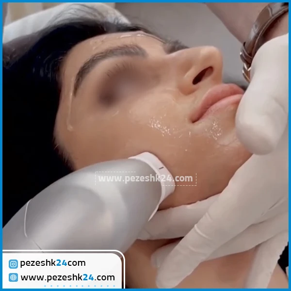 قبل و بعد از هایفو کلینیک ستایش تهران