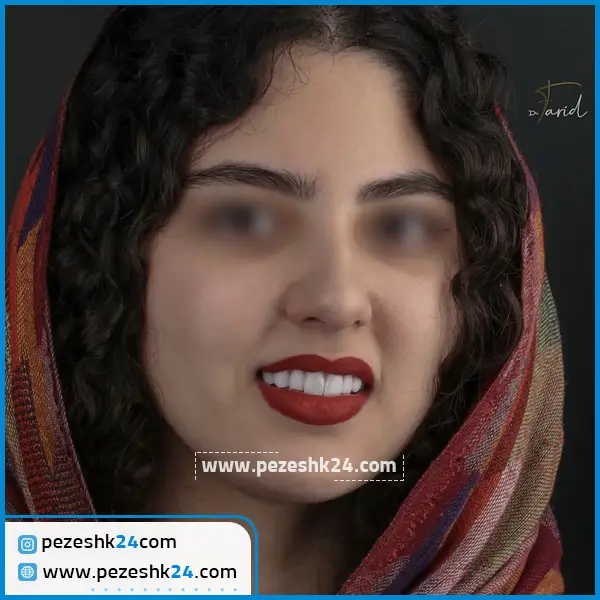 نمونه کامپوزیت دندان دکتر فرید فاضلی