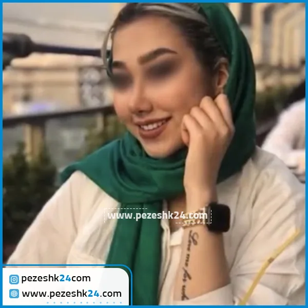 عمل زیبایی بینی دکتر عبدالمطلبی