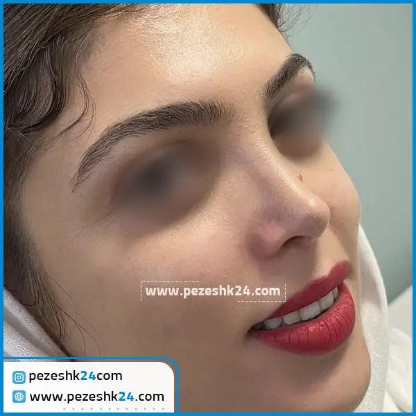 عمل بینی دکتر حمیدرضا مفرد