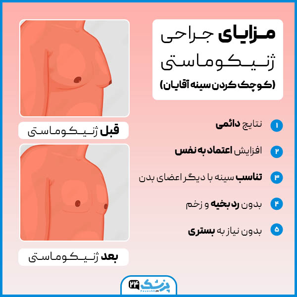 مـــزایـای جـراحی ژنیکوماستی در مشهد