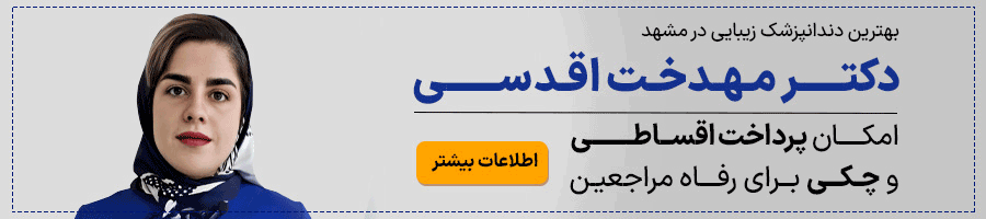 ایمپلنت اقساطی دکتر مهدخت اقدسی در مشهد